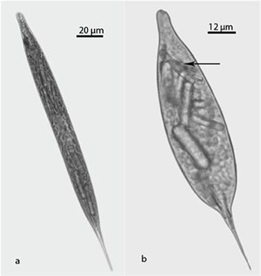 Ultrastructural Alterations in Lepocinclis acus (Euglenophyta) Induced by Medium with High Organic Matter Content